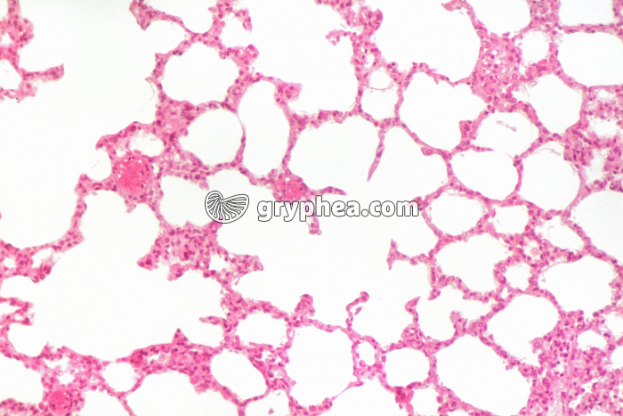 Poumon en CT x40 - gryphea.com